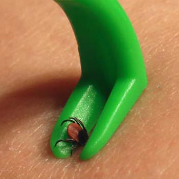 small hook removing a small tick from a human